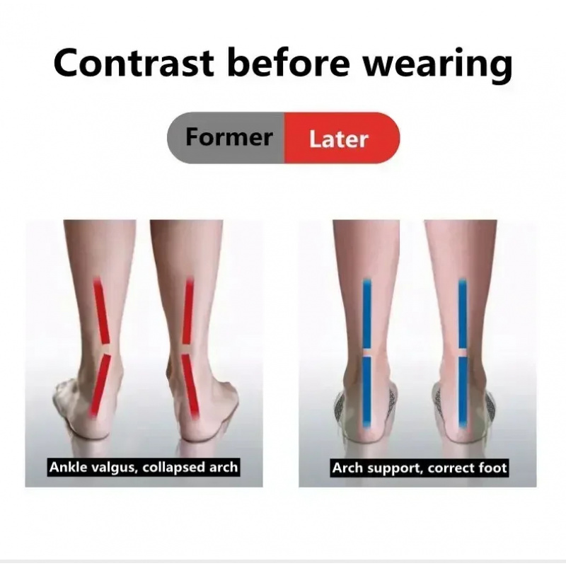 2 Pcs EVA Flat Feet Arch Suppo - Women'S Shoes For Flat Feet のレビューと価格