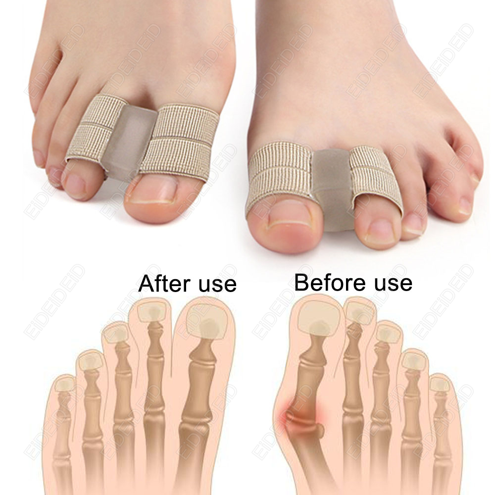 Bunion toe Corrector Orthotics - Women'S Shoes For Bunions のレビューと価格
